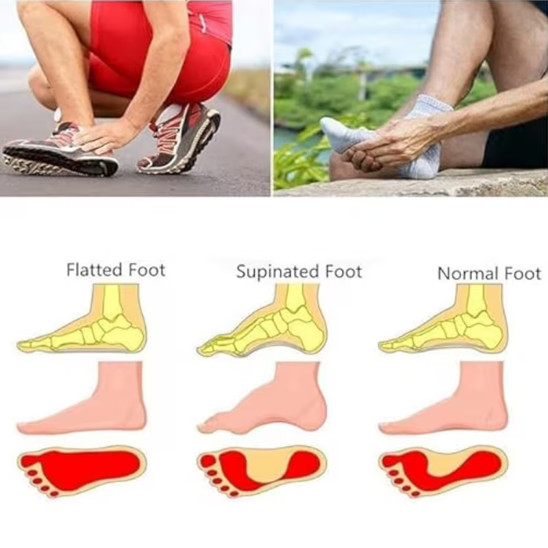 Uplift | 1 Pair Arch Support Brace with Compression Cushion